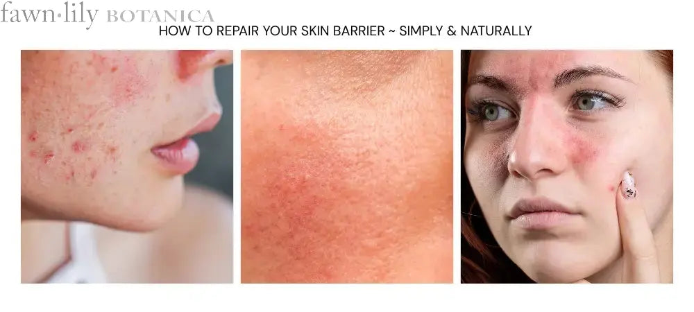Fawn Lily Botanica | How to repair skin barrier, easy and naturally 